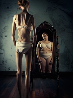 anorexia